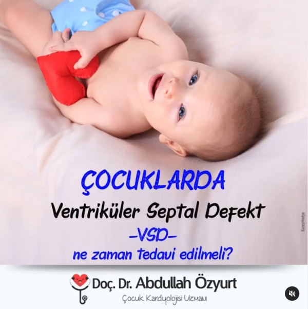 Çocuklarda VSD Ne Zaman Tedavi Edilmeli?