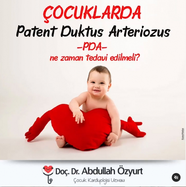 Çocuklarda PDA Ne Zaman Tedavi edilmeli?